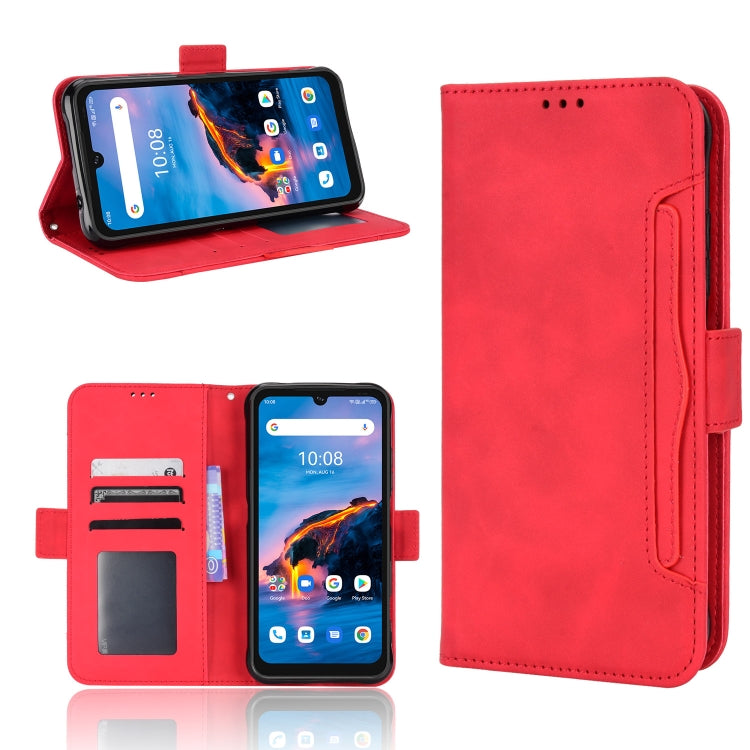 For Umidigi Bison X10G / X10G NFC Skin Feel Calf Pattern Leather Phone Case