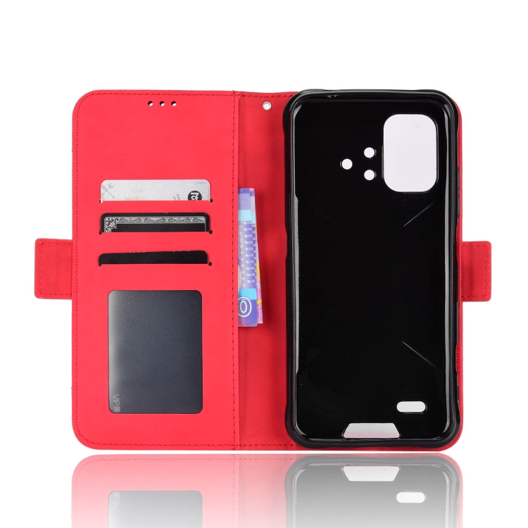 For Umidigi Bison X10G / X10G NFC Skin Feel Calf Pattern Leather Phone Case