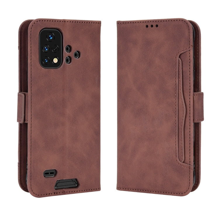 For Umidigi Bison X10G / X10G NFC Skin Feel Calf Pattern Leather Phone Case