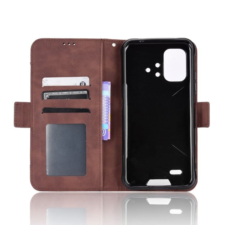 For Umidigi Bison X10G / X10G NFC Skin Feel Calf Pattern Leather Phone Case