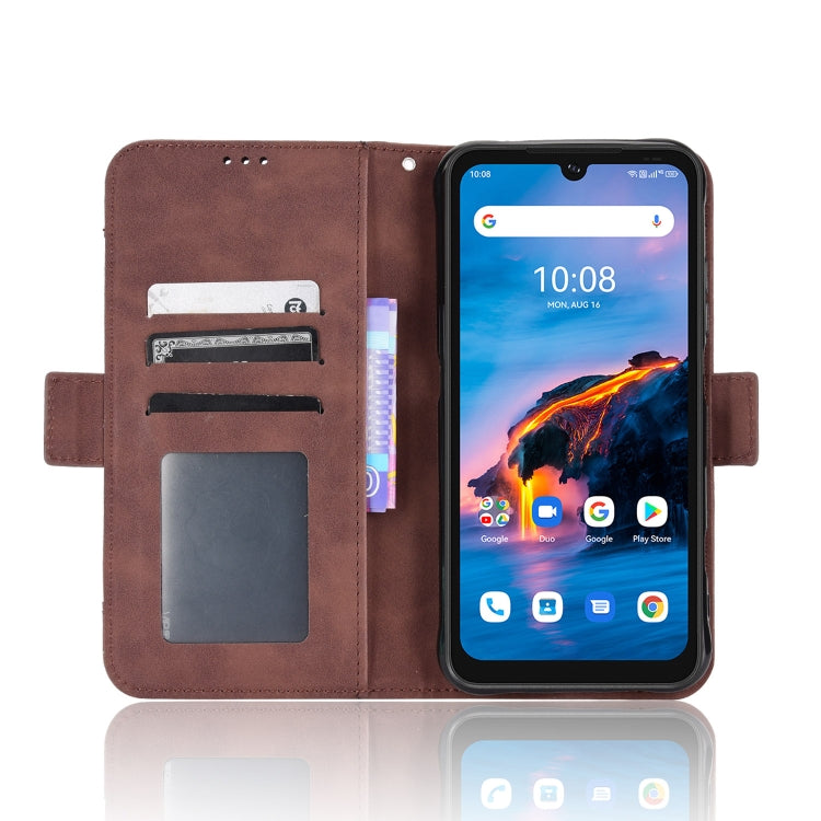 For Umidigi Bison X10G / X10G NFC Skin Feel Calf Pattern Leather Phone Case