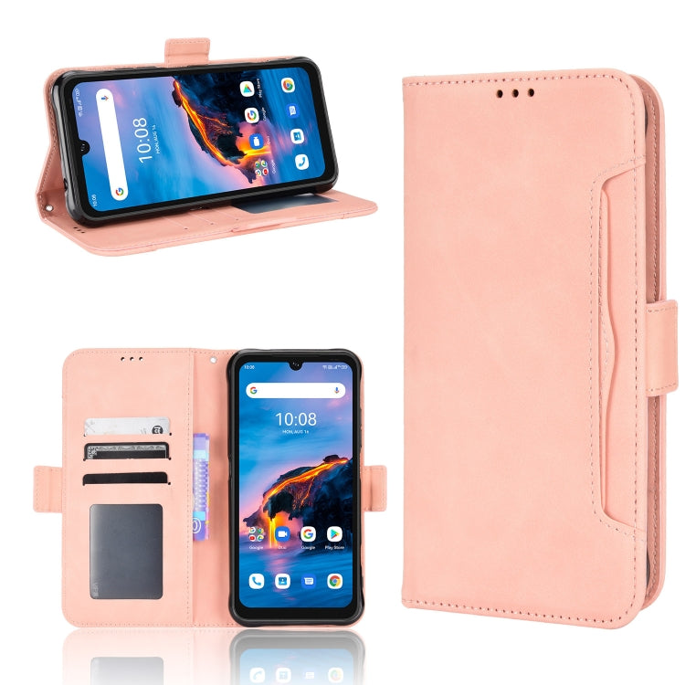 For Umidigi Bison X10G / X10G NFC Skin Feel Calf Pattern Leather Phone Case