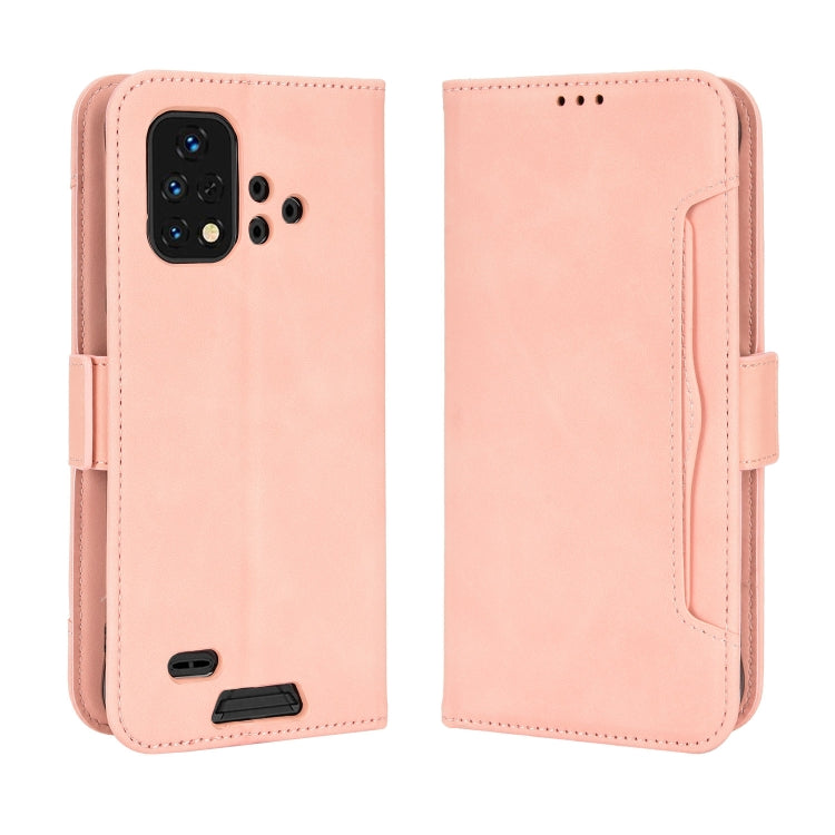 For Umidigi Bison X10G / X10G NFC Skin Feel Calf Pattern Leather Phone Case