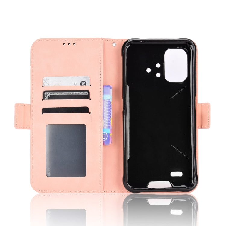 For Umidigi Bison X10G / X10G NFC Skin Feel Calf Pattern Leather Phone Case