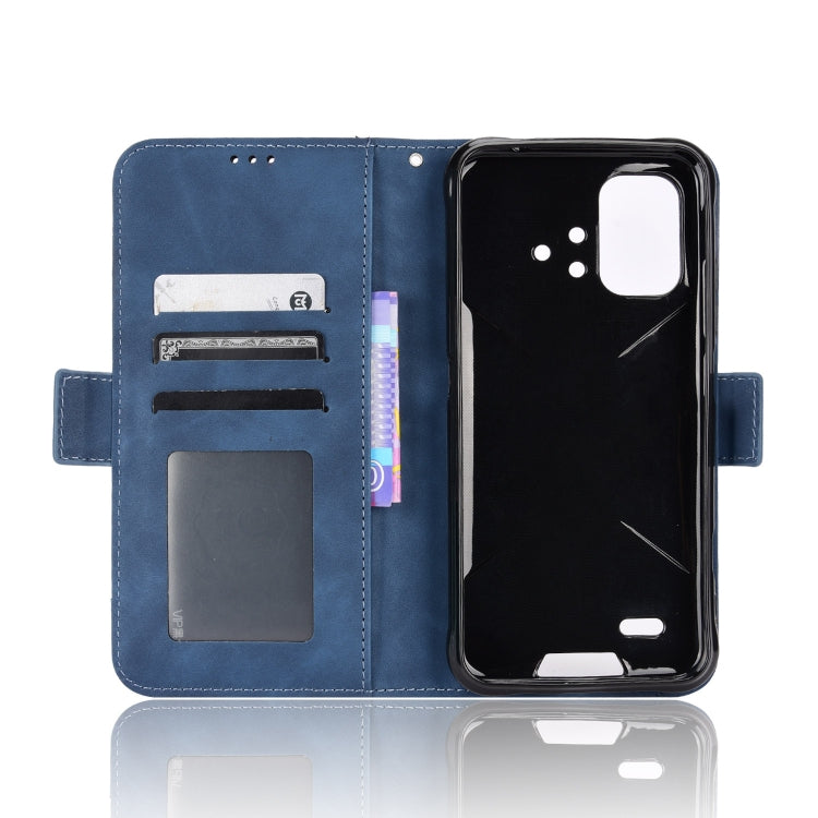 For Umidigi Bison X10G / X10G NFC Skin Feel Calf Pattern Leather Phone Case