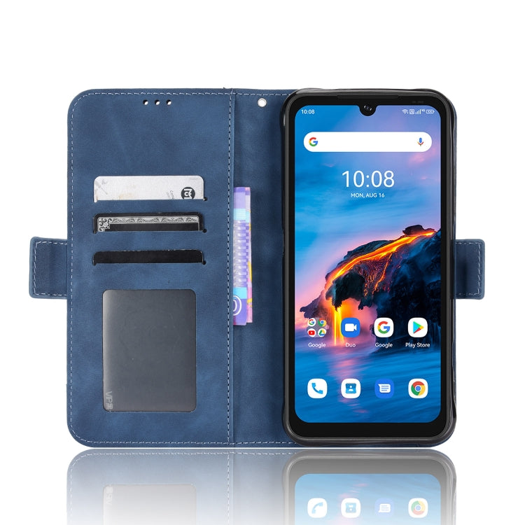 For Umidigi Bison X10G / X10G NFC Skin Feel Calf Pattern Leather Phone Case