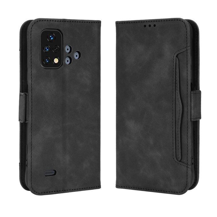 For Umidigi Bison X10S / X10S NFC Skin Feel Calf Pattern Leather Phone Case