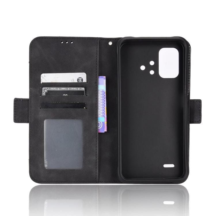 For Umidigi Bison X10S / X10S NFC Skin Feel Calf Pattern Leather Phone Case