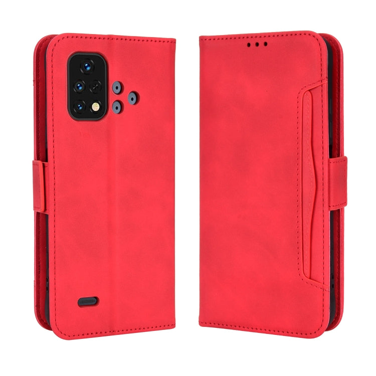 For Umidigi Bison X10S / X10S NFC Skin Feel Calf Pattern Leather Phone Case