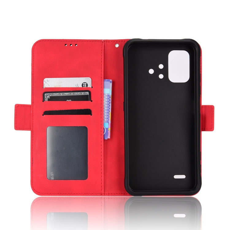 For Umidigi Bison X10S / X10S NFC Skin Feel Calf Pattern Leather Phone Case