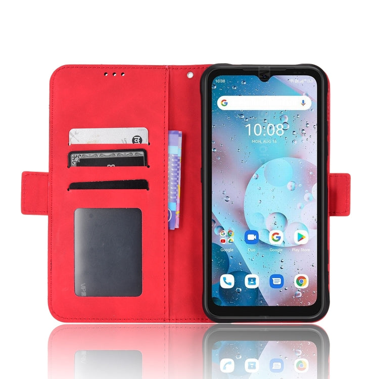 For Umidigi Bison X10S / X10S NFC Skin Feel Calf Pattern Leather Phone Case