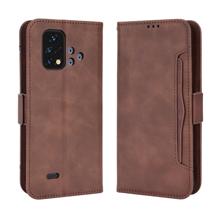 For Umidigi Bison X10S / X10S NFC Skin Feel Calf Pattern Leather Phone Case