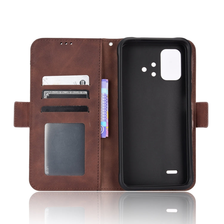 For Umidigi Bison X10S / X10S NFC Skin Feel Calf Pattern Leather Phone Case