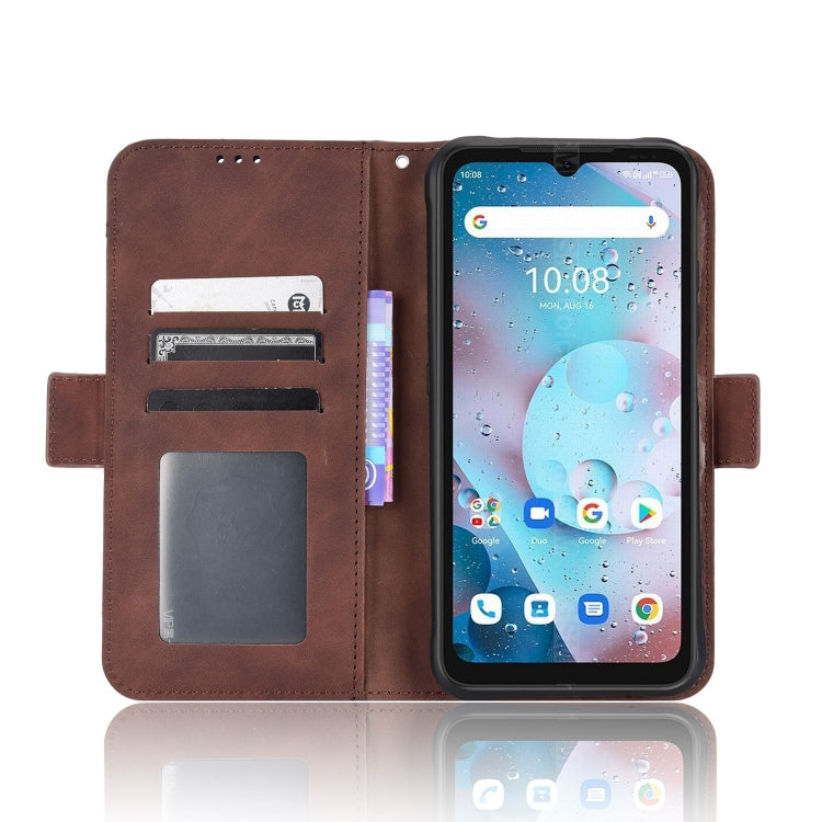 For Umidigi Bison X10S / X10S NFC Skin Feel Calf Pattern Leather Phone Case
