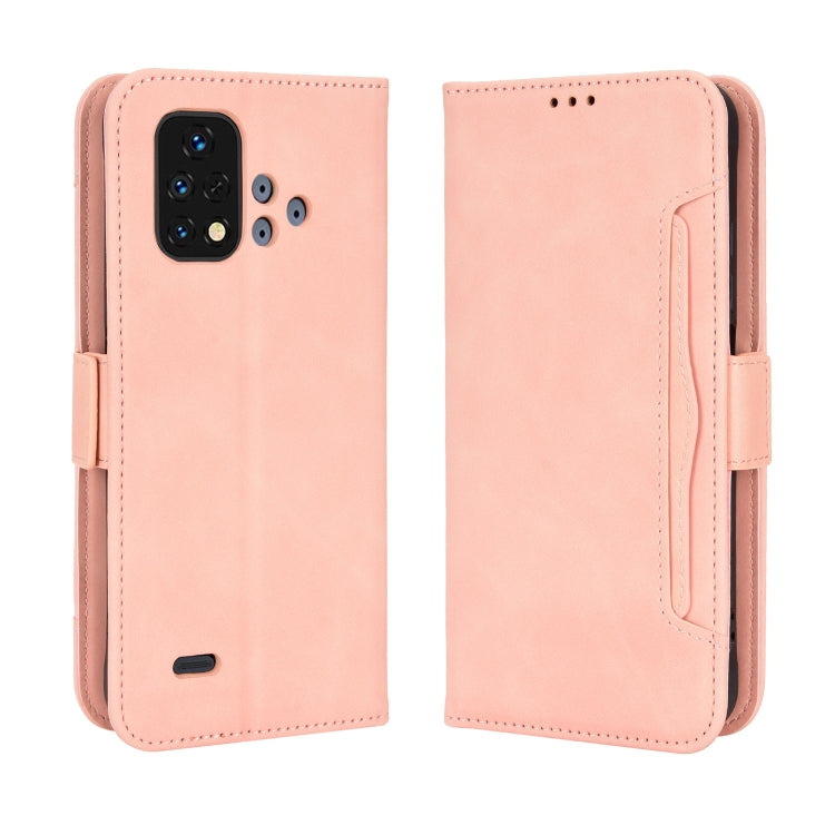 For Umidigi Bison X10S / X10S NFC Skin Feel Calf Pattern Leather Phone Case