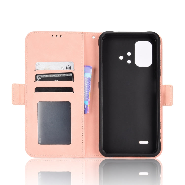 For Umidigi Bison X10S / X10S NFC Skin Feel Calf Pattern Leather Phone Case