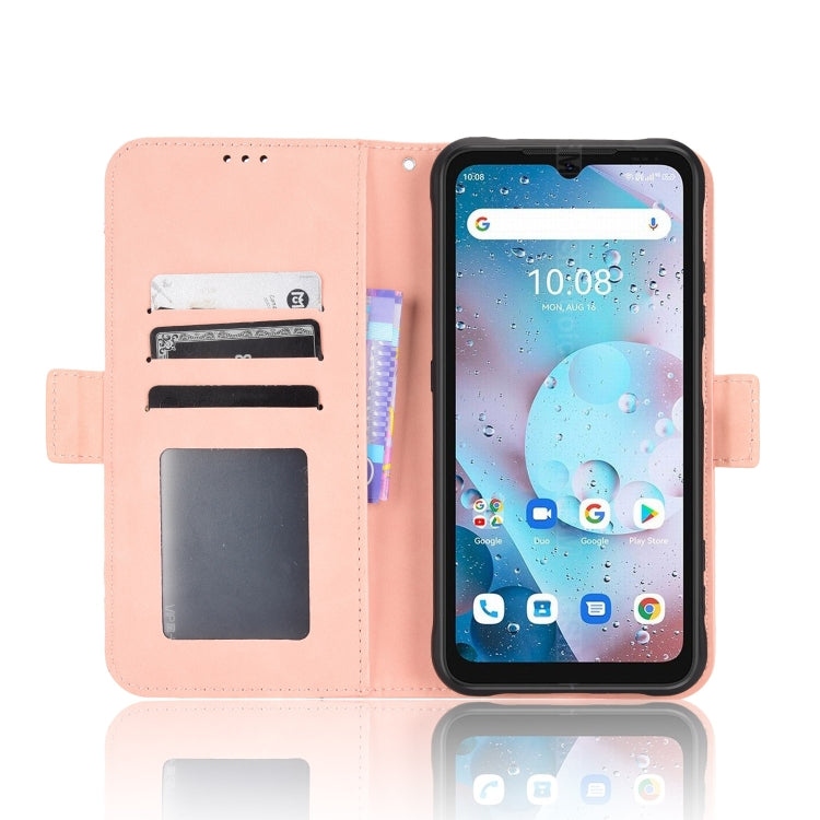 For Umidigi Bison X10S / X10S NFC Skin Feel Calf Pattern Leather Phone Case