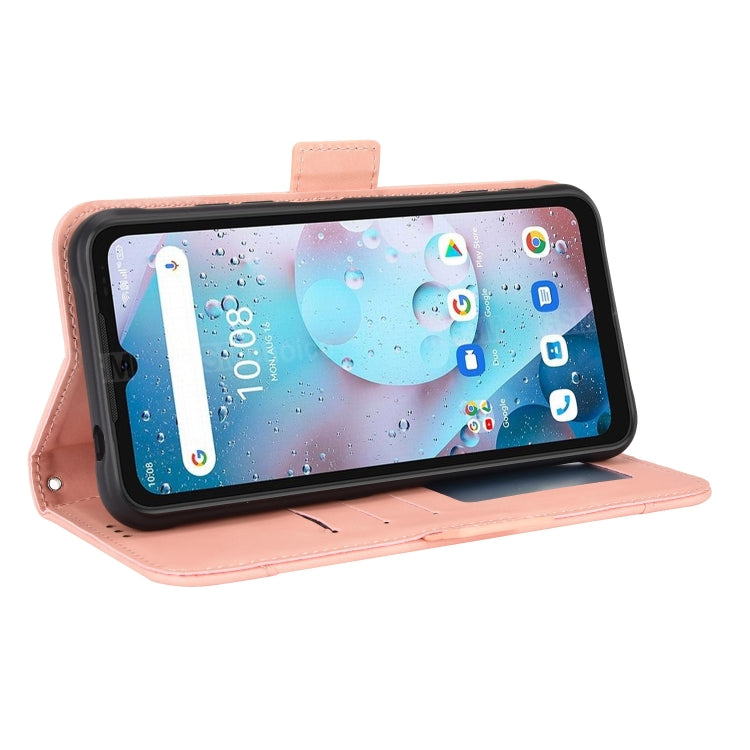 For Umidigi Bison X10S / X10S NFC Skin Feel Calf Pattern Leather Phone Case
