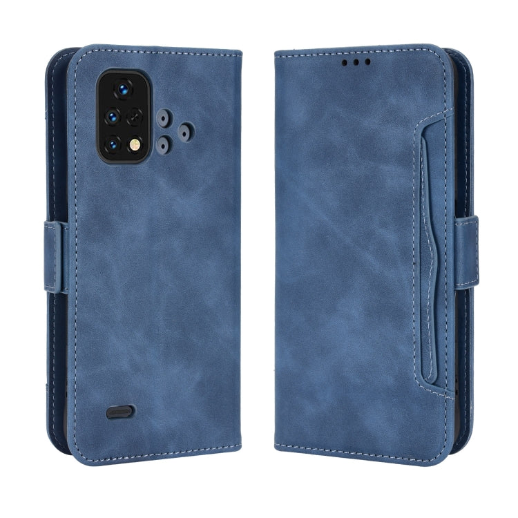 For Umidigi Bison X10S / X10S NFC Skin Feel Calf Pattern Leather Phone Case
