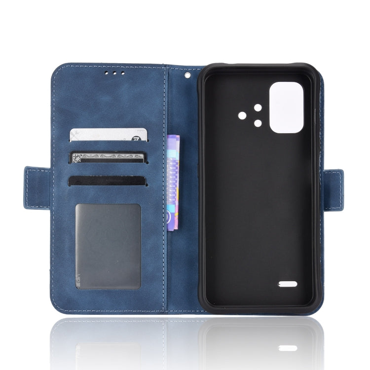 For Umidigi Bison X10S / X10S NFC Skin Feel Calf Pattern Leather Phone Case