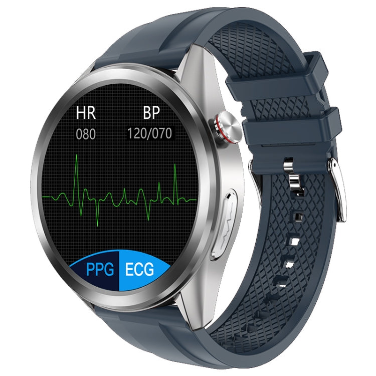 W10 1.3 inch Screen PPG & ECG Smart Health Watch, Support Heart Rate/Blood Pressure Monitoring, ECG Monitoring, Blood Oxygen/Body Temperature Monitoring