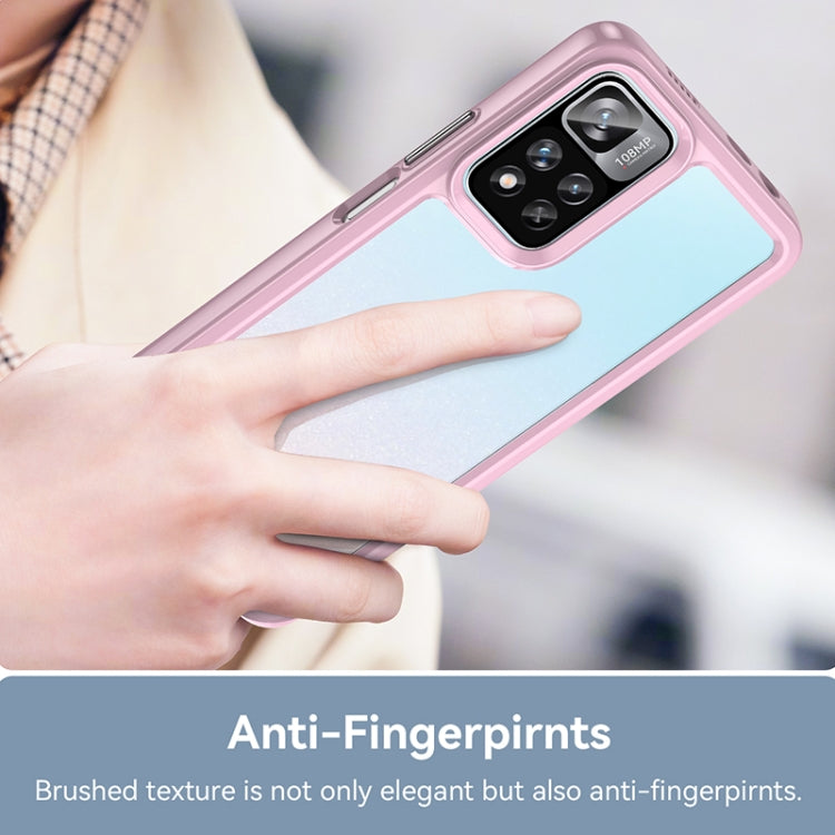 For Xiaomi Poco X4 NFC 5G Colorful Series Acrylic + TPU Phone Case