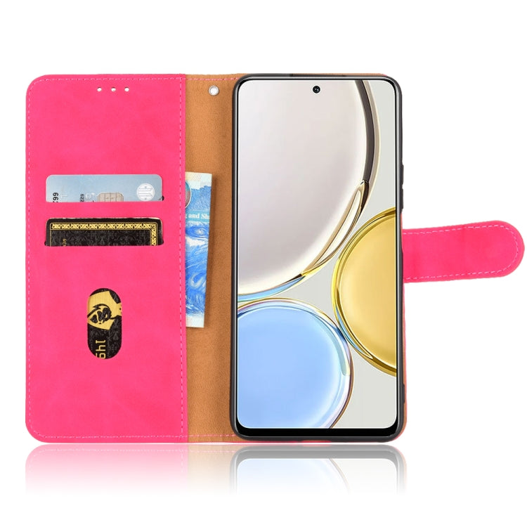 For Honor X9 5G/X30/Magic4 Lite Skin Feel Magnetic Flip Leather Phone Case