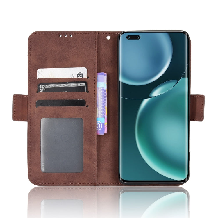 For Honor Magic4 Pro Skin Feel Calf Pattern Leather Phone Case