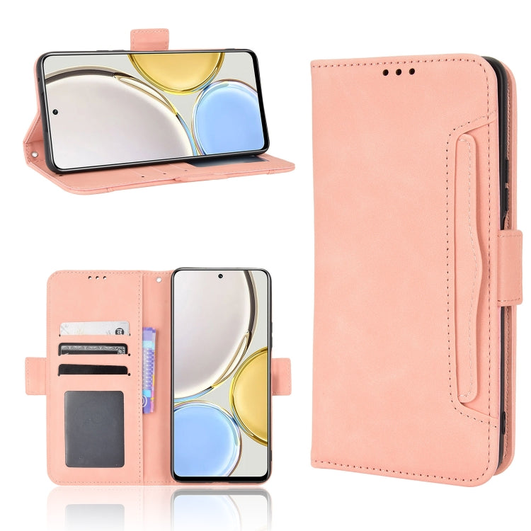 For Honor X9 5G / Magic4 Lite Skin Feel Calf Pattern Leather Phone Case