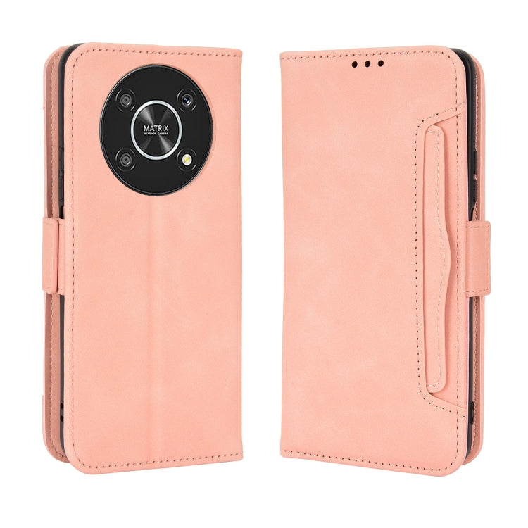 For Honor X9 5G / Magic4 Lite Skin Feel Calf Pattern Leather Phone Case