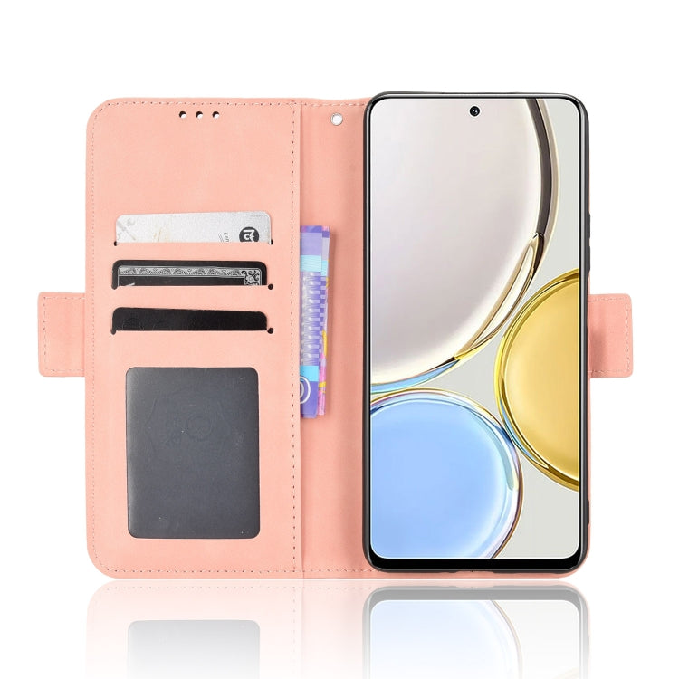 For Honor X9 5G / Magic4 Lite Skin Feel Calf Pattern Leather Phone Case