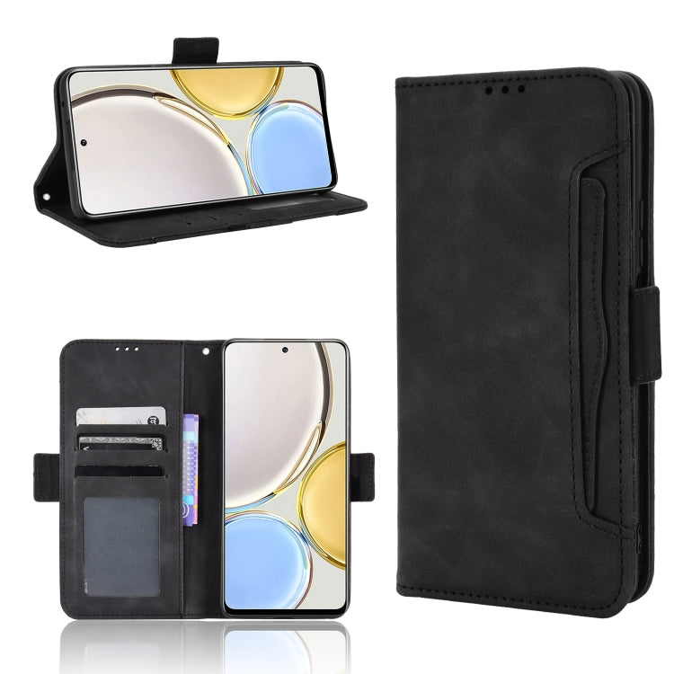 For Honor X9 5G / Magic4 Lite Skin Feel Calf Pattern Leather Phone Case