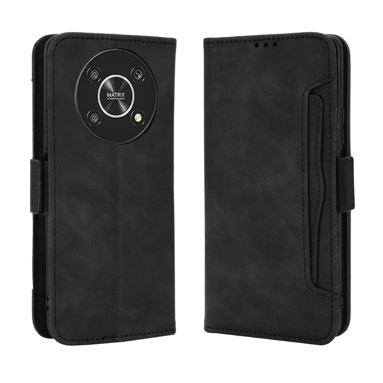 For Honor X9 5G / Magic4 Lite Skin Feel Calf Pattern Leather Phone Case