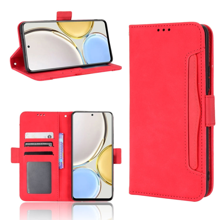 For Honor X9 5G / Magic4 Lite Skin Feel Calf Pattern Leather Phone Case