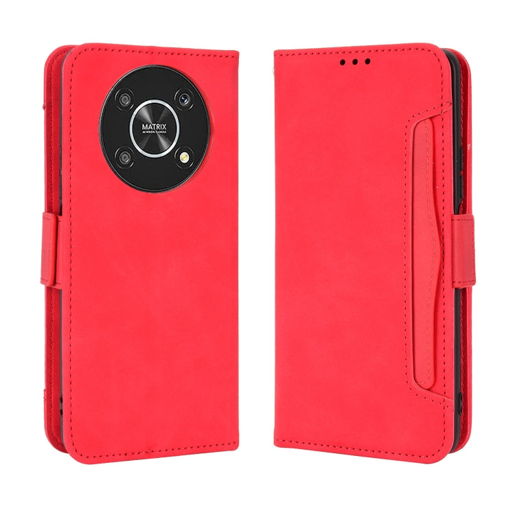 For Honor X9 5G / Magic4 Lite Skin Feel Calf Pattern Leather Phone Case