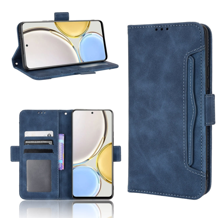 For Honor X9 5G / Magic4 Lite Skin Feel Calf Pattern Leather Phone Case