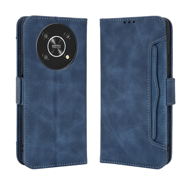 For Honor X9 5G / Magic4 Lite Skin Feel Calf Pattern Leather Phone Case