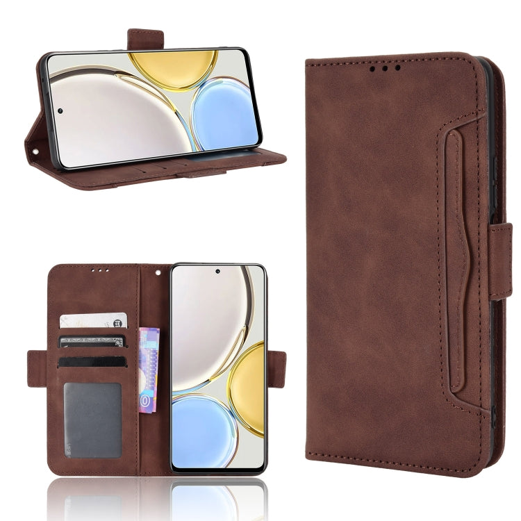 For Honor X9 5G / Magic4 Lite Skin Feel Calf Pattern Leather Phone Case