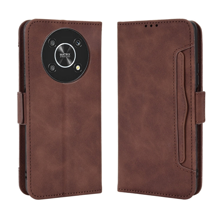 For Honor X9 5G / Magic4 Lite Skin Feel Calf Pattern Leather Phone Case
