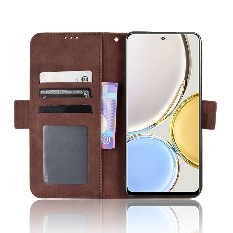 For Honor X9 5G / Magic4 Lite Skin Feel Calf Pattern Leather Phone Case