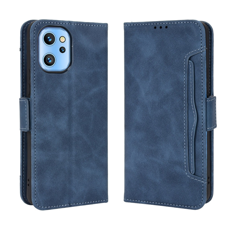 For UMIDIGI A13 / A13 Pro / A13S Skin Feel Calf Pattern Leather Phone Case