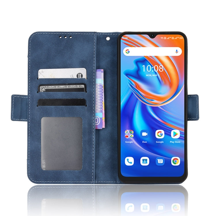 For UMIDIGI A13 / A13 Pro / A13S Skin Feel Calf Pattern Leather Phone Case
