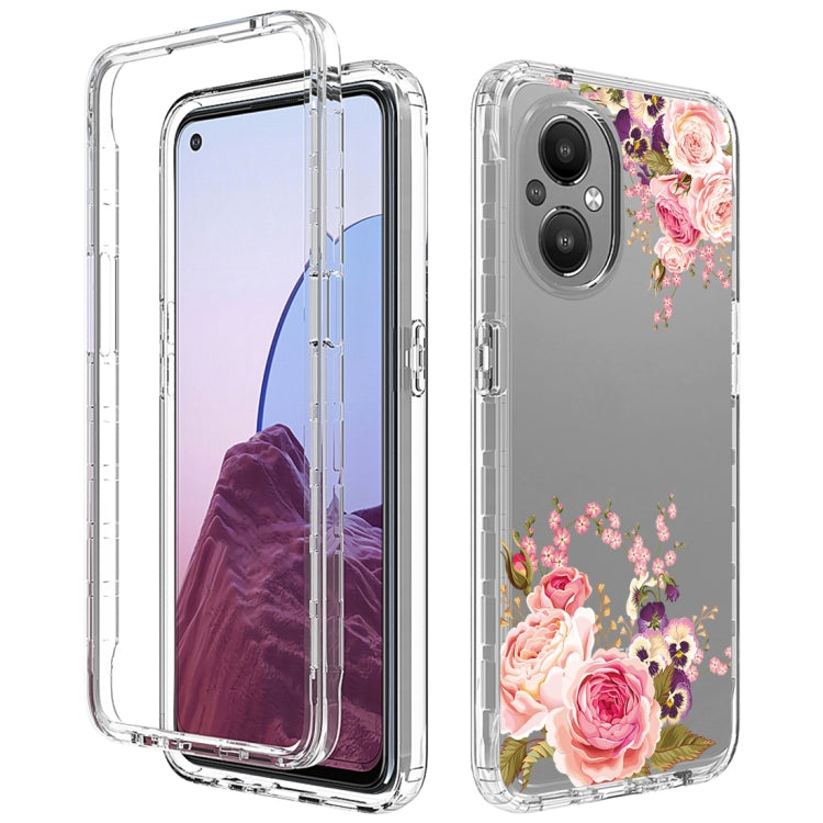 For OnePlus Nord N20 5G PC+TPU Transparent Painted Phone Case