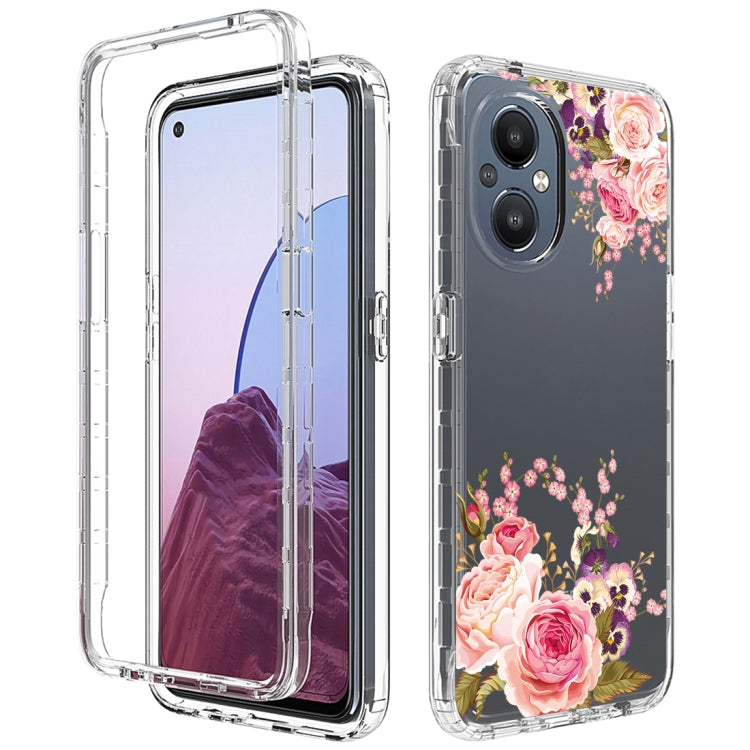 For OnePlus Nord N20 5G PC+TPU Transparent Painted Phone Case