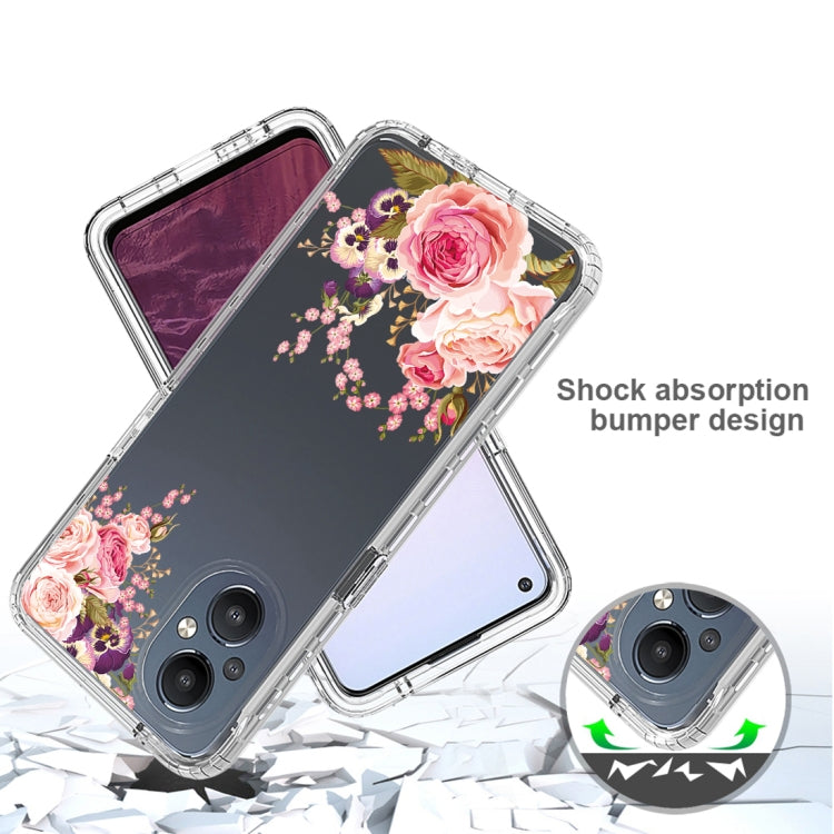 For OnePlus Nord N20 5G PC+TPU Transparent Painted Phone Case