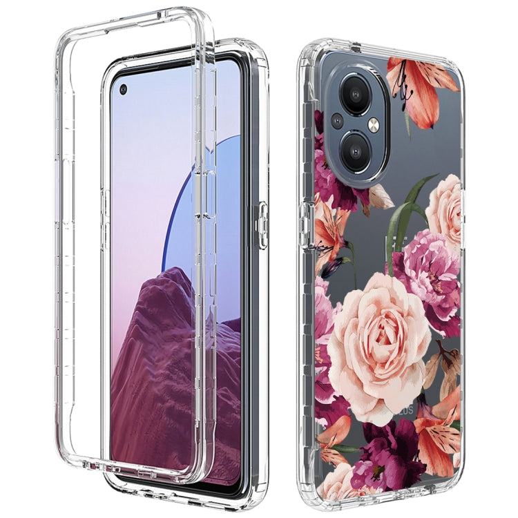 For OnePlus Nord N20 5G PC+TPU Transparent Painted Phone Case
