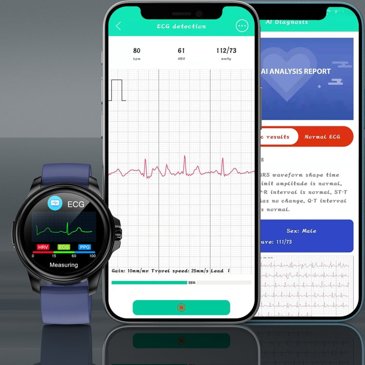 E89 1.32 Inch Screen TPU Strap Smart Health Watch Supports ECG Function, AI Medical Diagnosis, Body Temperature Monitoring