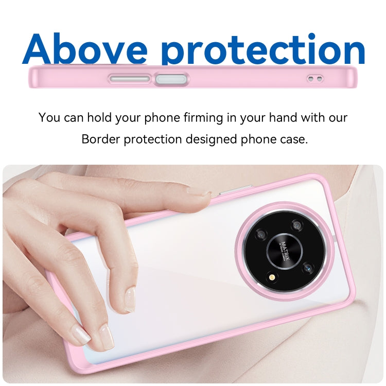 For Honor Magic4 Lite Colorful Series Acrylic + TPU Phone Case