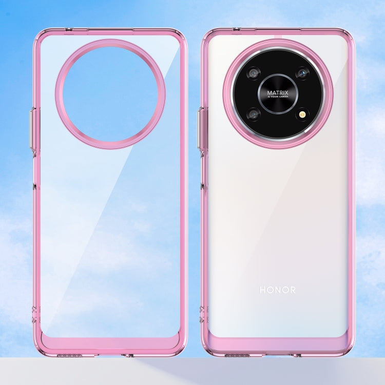 For Honor Magic4 Lite Colorful Series Acrylic + TPU Phone Case