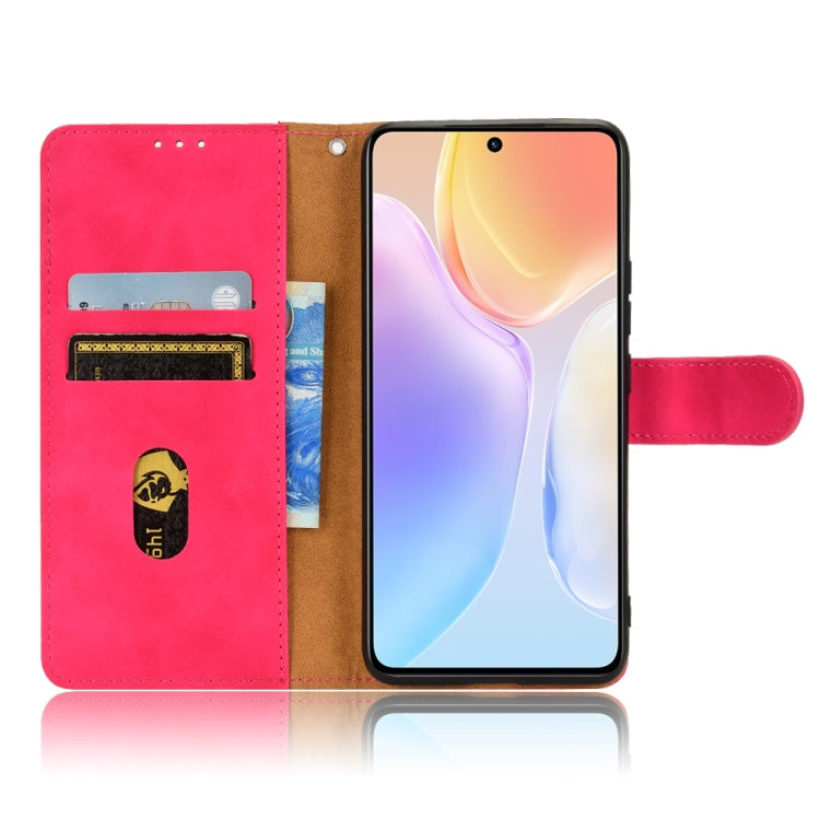 For vivo X70 Skin Feel Magnetic Flip Leather Phone Case